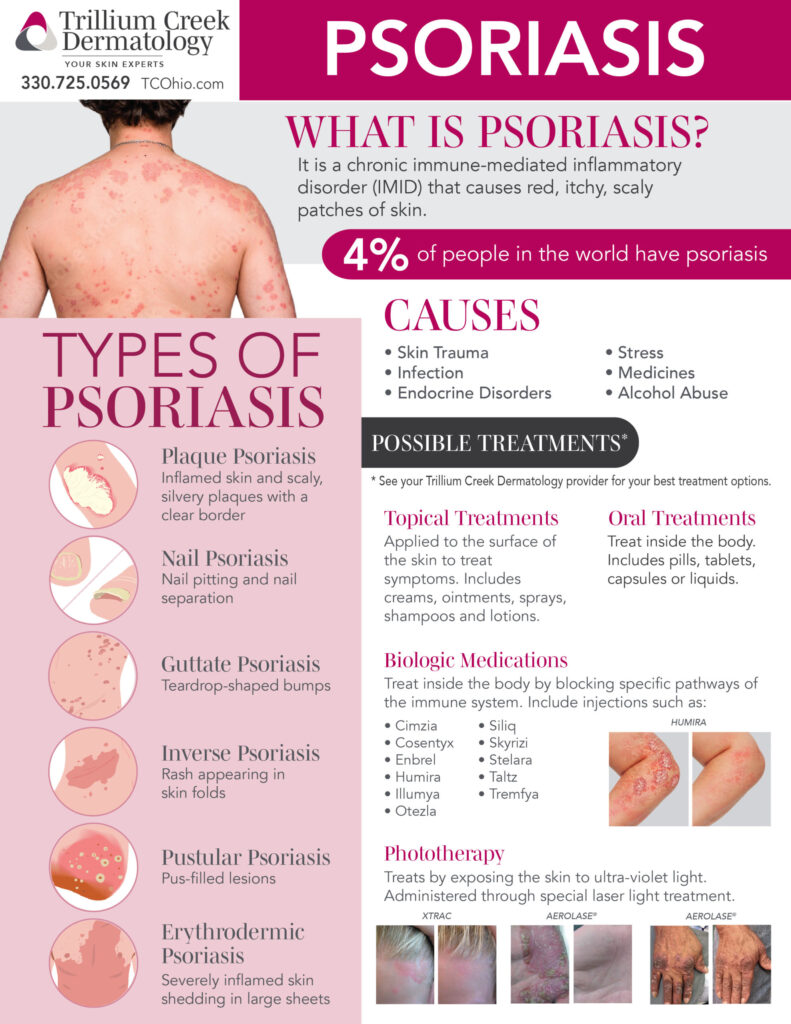 Chronic Inflammation Psoriasis Management: Best Strategies & Tips